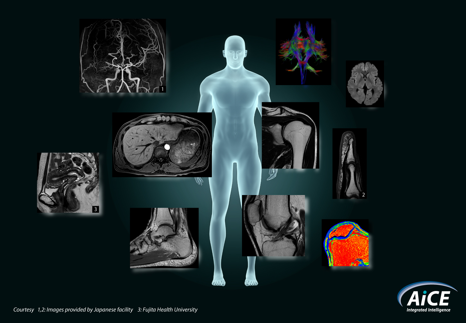 MR_AiCE_whole body_202101